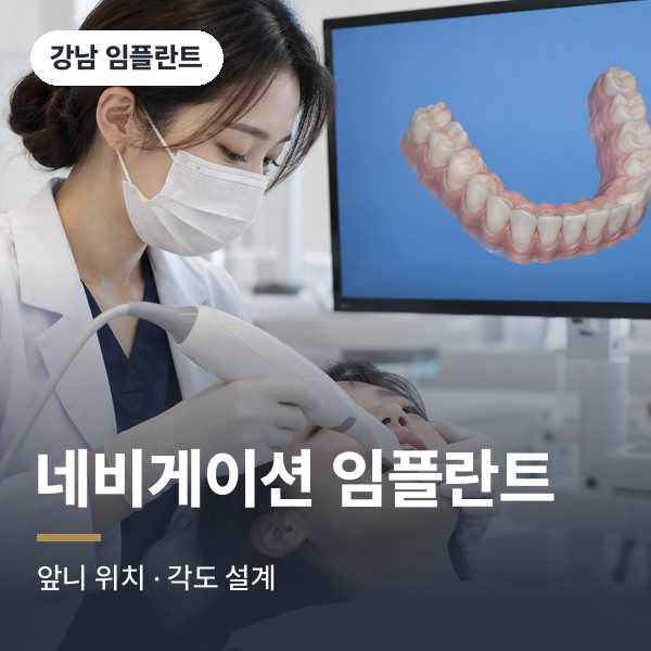 네비게이션 임플란트